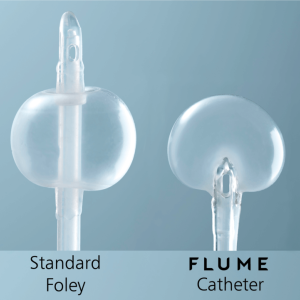standard foley vs. flume catheter