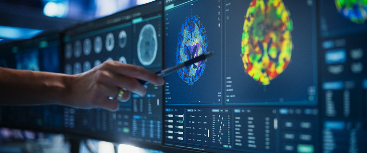 A doctor's hand points at a computer monitor with a neurologic CT scan.